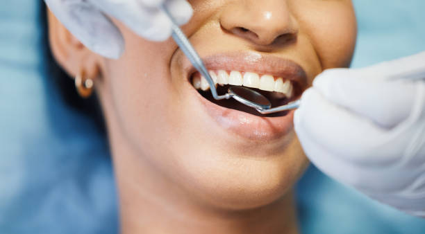 Best Emergency Treatment for Dental Infections or Abscesses in Excelsior Springs, MO